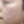 Chemical peel — before (35days) · J.Fill Clinic - Gangnam Branch