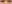 裏ハムラ法（経結膜的眼窩脂肪移動術） — ファクト美容外科クリニック