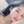 โบท็อกซ์กราม (ฉีดลดกราม) — หลังทำ (180วัน) · คลินิกโอเปร่าทำศัลยกรรม