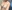Hybrid breast augmentation (implant + fat grafting) — Eight Plastic Surgery Clinic