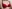 豊胸術（シリコンインプラント／人工乳腺） — エイト美容外科クリニック