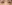 目尻切開 — プロミス美容外科クリニック