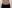 Arm liposuction — Balance Lab Plastic Surgery