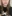 Lip filler (lip augmentation with HA) — Pladen Plastic Surgery Clinic
