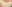 豊胸（脂肪注入） — ソウルアイ美容外科クリニック