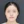 two-jaw surgery (bimaxillary orthognathic surgery) — before (40days) · ReFace Dental Hospital