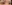 二重まぶた（自然癒着法） — フルルン美容外科クリニック