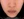 Volnewmer (โวลนิวเมอร์ ยกกระชับด้วย RF) — หลังทำ (21วัน) · คลินิกพาร์ควิว สาขาจัมซิล