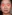 revision rhinoplasty — Coco Line Clinic