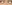 二重まぶた（自然癒着法） — ルホ美容外科クリニック