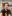 Ptosis Correction (levator surgery / eye-shape correction) — Jesta Plastic Surgery Clinic