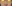 鼻尖形成術（自家軟骨移植） — ベリーグッド美容外科