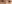 二重まぶた（自然癒着法） — オブジェ美容外科クリニック