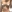 豊胸術（シリコンインプラント／人工乳腺） — ソウルアイ美容外科クリニック