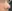 Ptosis Correction (levator surgery / eye-shape correction) — Wonjin Plastic Surgery Clinic