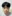 Revision facial contouring surgery (secondary facial bone surgery) — WHY Oral and Maxillofacial Surgery & Dental Clinic