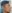 jaw angle reduction (mandibular angle osteotomy) — Uri Plastic Surgery Clinic