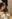 二重あごの脂肪吸引（顎下脂肪吸引） — セギム美容外科クリニック