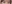 埋没法（二重埋没法） — プロミス美容外科クリニック