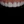 Orthodontic treatment (braces) — after (7days) · Gangnam Clear Dental Clinic