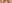 裏ハムラ法（経結膜的眼窩脂肪移動術） — プレジャー美容外科クリニック