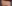 お腹の脂肪溶解注射 — 清潭My美容外科