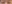 二重まぶた（自然癒着法） — プランナー美容外科クリニック