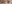 二重まぶた（自然癒着法） — デビビ美容外科クリニック