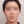 太阳穴自体脂肪填充 — 术后 (14天) · The整形外科