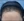 Scalp hair transplant — after (7days) · Do Jagi Clinic