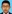 鼻尖形成術（自家軟骨移植） — ハイエンド美容外科クリニック