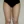 Full-body liposuction — after (21days) · Aurora Clinic