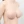 乳房固定術（バストリフト） — 術後 (30日) · エイビー美容外科クリニック