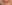 人中短縮（リップリフト） — ドクタータク美容外科クリニック
