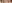 眼瞼下垂手術（目つき矯正） — Unique Plastic Surgery Clinic