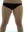 Buttock Liposuction — before (30days) · Body Up Clinic