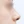 Nasal osteotomy (nasal bone narrowing) — after (7days) · Pop Plastic Surgery Clinic