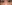 目の下の脂肪注入（くぼみ・クマ治療） — ST美容外科(エスティ美容外科)