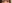 二重まぶた（自然癒着法） — プロミス美容外科クリニック