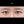 ผ่าตัดแก้ขนตาทิ่มตา (ขนตาแยงตา / เปลือกตาม้วนเข้า) — ก่อนทำ (7วัน) · รพ.ศัลยกรรมตกแต่งโอลโล