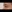 雙眼皮（自然沾黏法） — Lala醫美診所