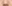 鼻尖形成術（自家軟骨移植） — ルホ美容外科クリニック
