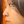 Nose tip filler — before · Erne Clinic