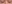 二重まぶた（自然癒着法） — ルホ美容外科クリニック