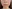 Juvelook (PDLLA + HA collagen-stimulating skin booster) — You&I Clinic - Myeongdong Branch