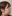 顔の脂肪溶解注射（小顔注射） — ロリポップ美容外科クリニック