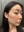 skin booster injection (water glow injection) — before (7days) · Pladen Plastic Surgery Clinic