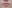 Lower Eyelid Fat Repositioning (transconjunctival) — Sugar Plastic Surgery