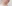 二重あごの脂肪吸引（顎下脂肪吸引） — クレア美容外科クリニック
