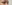 二重まぶた（自然癒着法） — フルルン美容外科クリニック